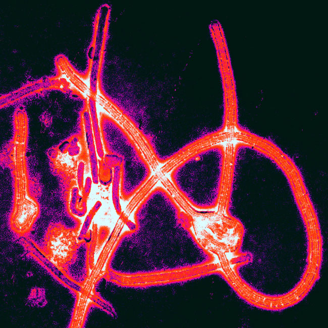 Imaxe ao microscopio do virus do ébola.