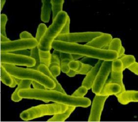 O mycobacterium tuberculosis.