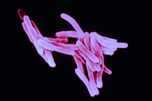 A bacteria "Mycobacterium tuberculosis" destrúe o tecido pulmonar.