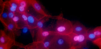 Células tumorais cultivadas en laboratorio. Fonte: SINC / NIH.