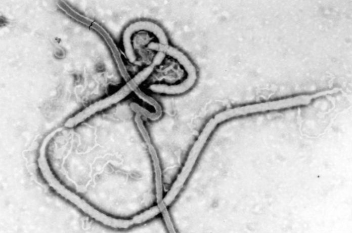 Imaxe microscópica do virus do ébola, unha das doenzas incluídas pola OMS na lista na que tamén está a Enfermidade X.