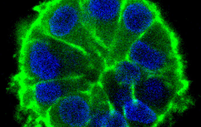 Crecemento acinar de células tumorais no modelo 3D de microambiente tumoral en hidroxeles de rede interpenetrante. Imaxe: Ciberonc/ISCIII.