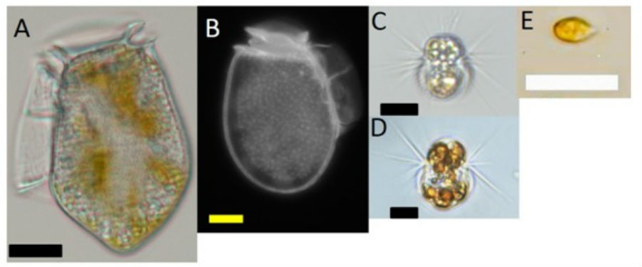 Micrografías de (A) Dinophysis acuta, (B) D. cuminata, (C) cepa española y (D) danesa de Mesodinium rubrum y (E) Teleaulax amphioxeia. Escalas: (A) 20 μm, (B‐E) 10 μm.