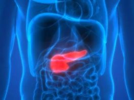 O cancro de páncreas é un dos cancros máis mortais.