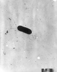 Imaxe ao microscopio da  "Listeria monocytogenes".