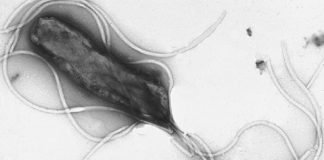 Imaxe ao microscopio da bacteria "Helicobacter pylori". Fonte: Yutaka Tsutsumi.