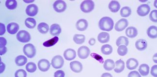 Frotis sanguíneo de "Plasmodium falciparum", protozoo causante da malaria. Fonte: Center for Disease Control.