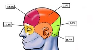 A maioría dos participantes no estudo manifestou unha dor xeral na cabeza, máis intensa na zona frontal. Fonte: Dicyt.