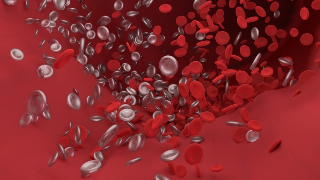 Son varios os factores vinculados a un maior risco de coágulos sanguíneos. Foto: Pixabay.