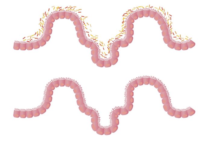 A relación entre a actividade do intestino e o pulmón inflúe tamén na resposta a enfermidades infecciosas. Foto: Pixabay.