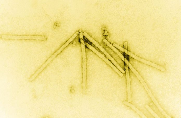 Imaxe ao microscopio do virus do mosaico do tabaco. Fonte: Wikicommons.