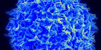 Imaxe de micrografía din linfocito T, axente clave no sistema inmunitario. Fonte: NIAID.