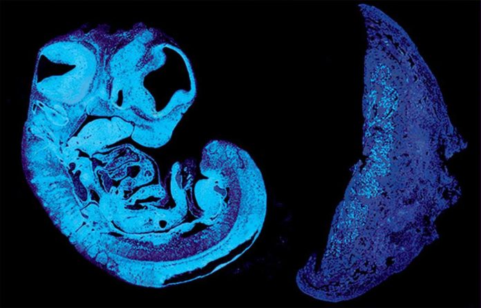 Sección dun feto de rato y e a súa placenta. Foto: Ionel Sandovici