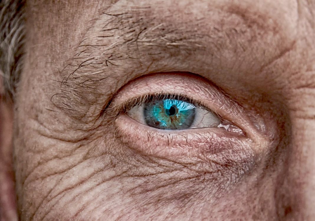 Os ollos tamén son testemuño do envellecemento. Foto: Pixabay