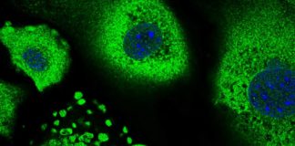 Un queratinocito sometido á división celular rodeado de queratinocitos senescentes. O gran tamaño das células e o seu núcleo é unha característica típica da senescencia, un proceso biolóxico que ten un rol importante na supresión de tumores. Crédito: Annagiulia Ciocia | CRG