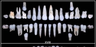 Dentes pertencentes ao individuo XVIII (arriba) e XXV (abaixo) da Sima de los Huesos. Foto: Mario Modesto Mata