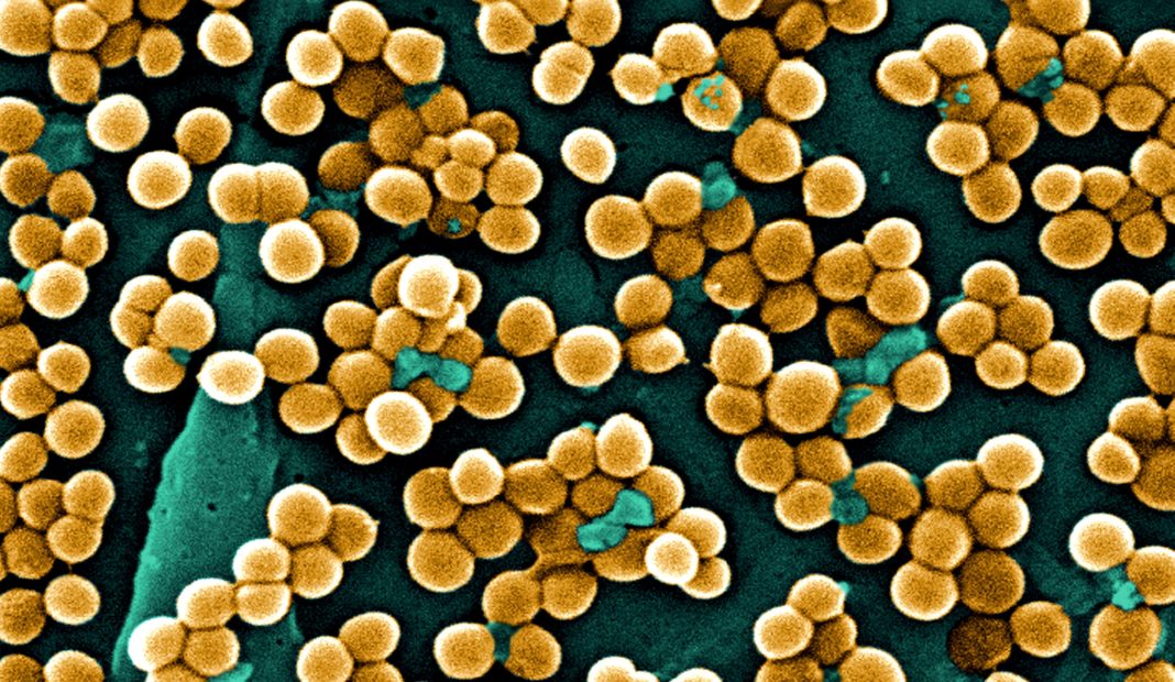 Vista do estafilococo dourado, resistente a antibiótico. Crédito: USCDCP