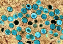 Imaxe a cor de partículas de varíola do mono nunha célula infectada (marrón) cultivda en laboratorio. Crédito: NIAID. Flikr NIAID , CC BY-SA