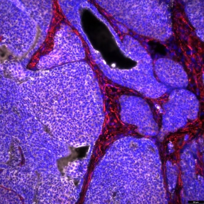 Cancro de mama en rato, con células tumorais en branco. Crédito: Raúl Jiménez / CSIC