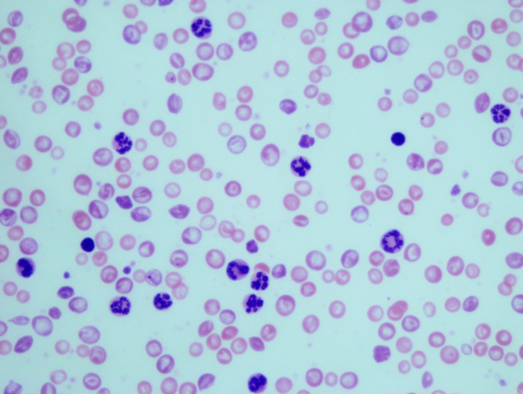 Granulocitos en mostras sanguíneas de ratos con leucemia mieloide crónica. Crédito: CSIC