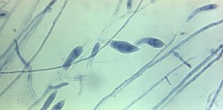 O fungo 'Trychophyton tonsurans'. Crédito: CDC Public Health Image Library (PHIL)