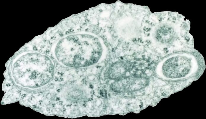 Micrografía electrónica de transmisión de 'Wolbachia' nunha célula de insecto. Crédito: Wikimedia Commons / Scott O'Neill, CC BY-SA