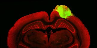 Imaxe histolóxica dun cerebro de rata cun organoide cerebral humano enxertado. Crédito: Jgamadze et al.