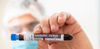 O 13 de febreiro Guinea Ecuatorial notificou un gromo do virus de Marburgo. Crédito: Shutterstock / Mauro Rodrigues