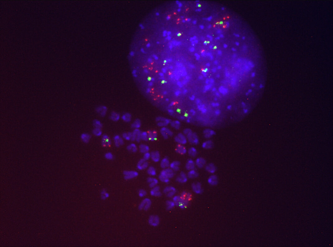Células do cancro de pulmón resistentes ao Sotorasib que presentan varias copias do xene KRAS mutado (en vermello). Crédito: CIC