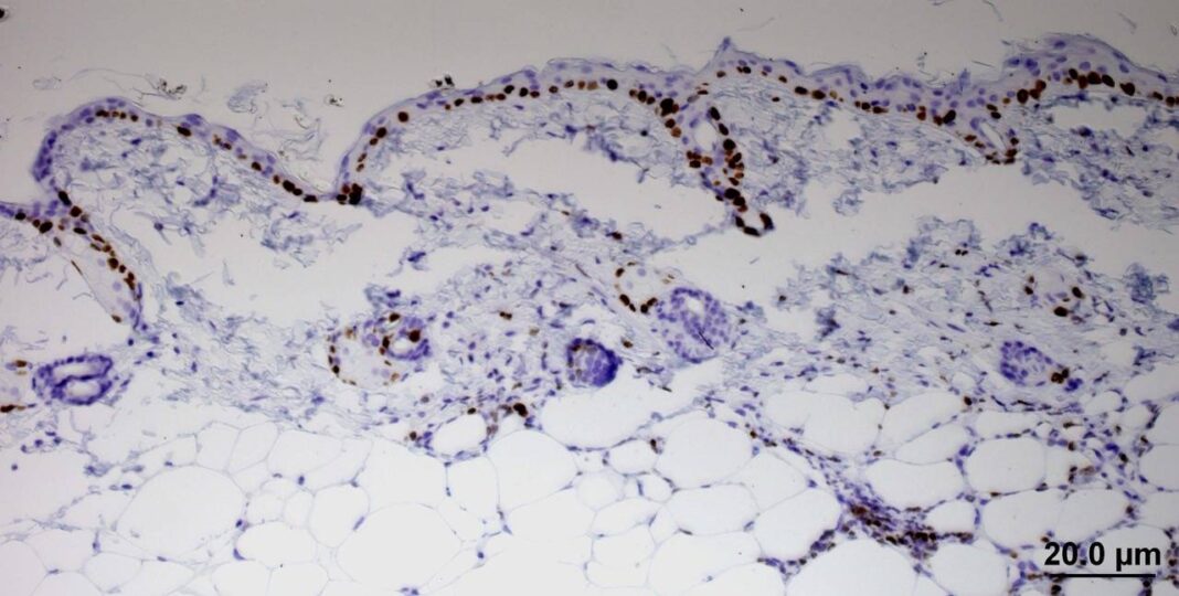 Células epiteliais de rato. Crédito: CNIO