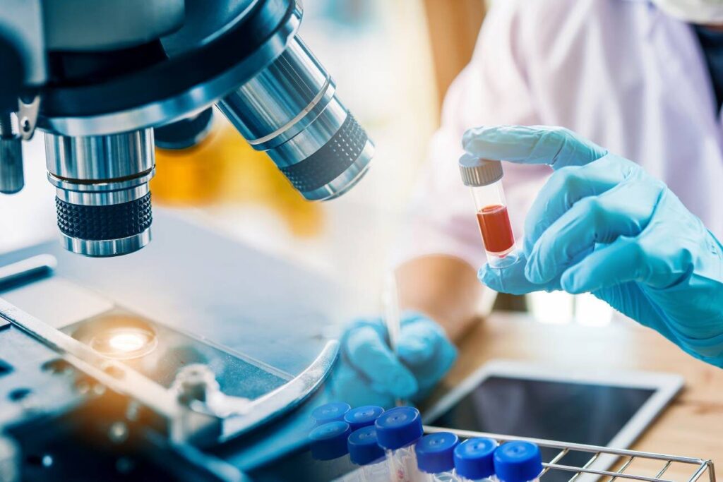 O estudo marca posibles biomarcadores de diagnóstico e información de tratamento. Foto: Adobe Stock.