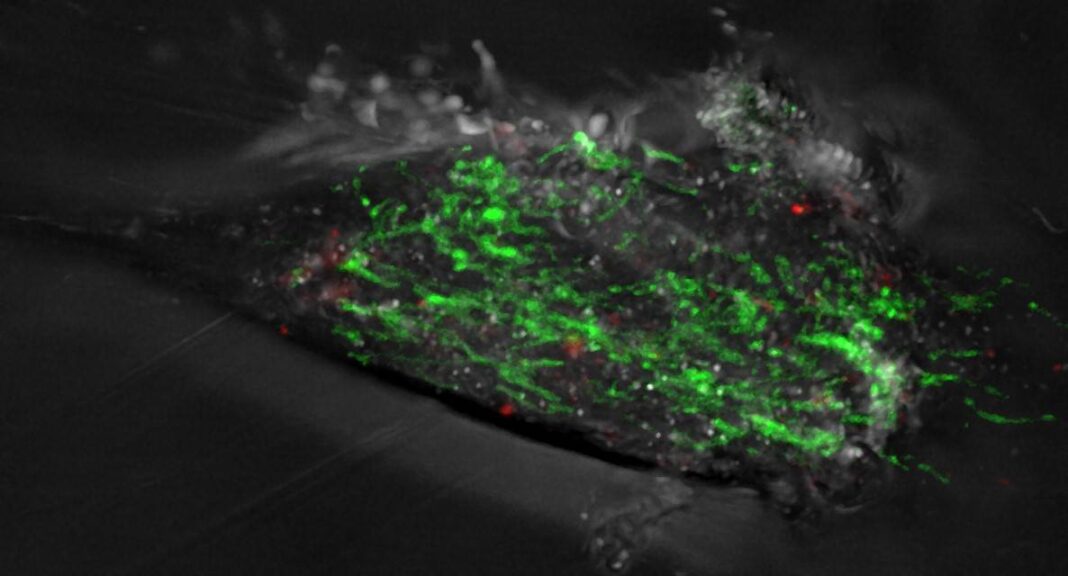Fibroblasto de paciente de párkinson, con mitocondrias (verde) e fragmentos de mitocondrias danadas (vermello). Foto: IIBB-CSIC