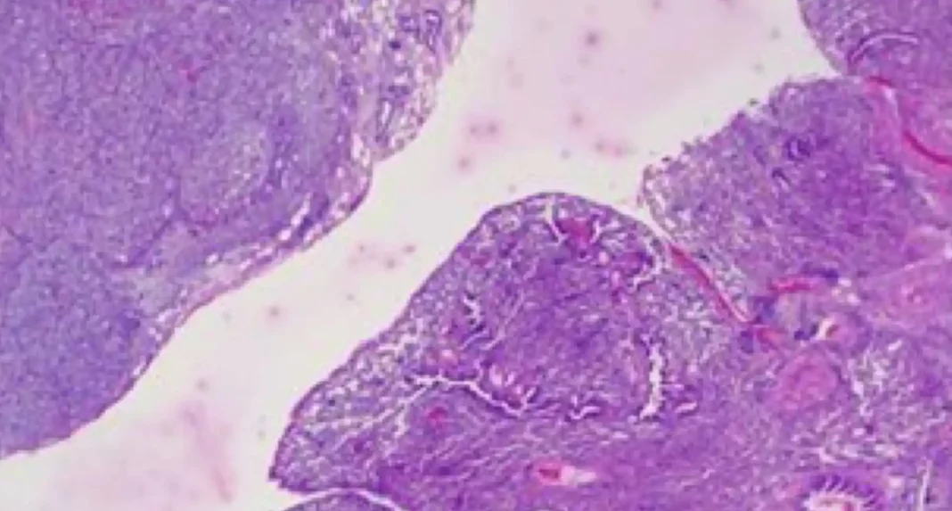 Tinguido dun cancro de pulmón KRAS mutado. Foto: CIC-CSIC-USAL