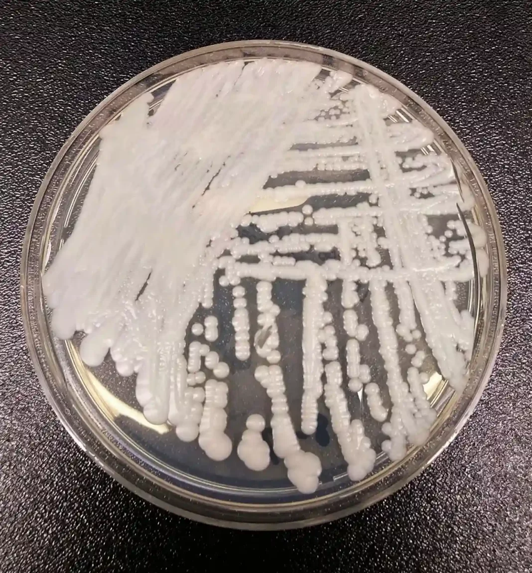 Unha mostra de Candida auris