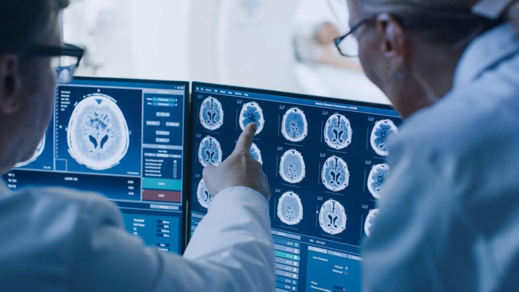 O alzhéimer provoca unha perda progresiva de neuronas e conexións cerebrais. O novo sistema experimental ten como obxectivo promover a rexeneración neuronal a partir dos astrocitos. Imaxe: Adobe Stock